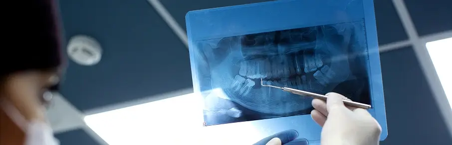 Modelo dentário