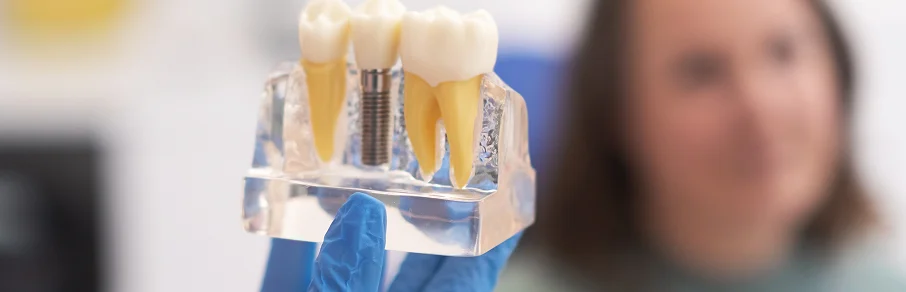 Modelo dentário