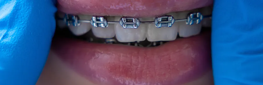 Modelo dentário